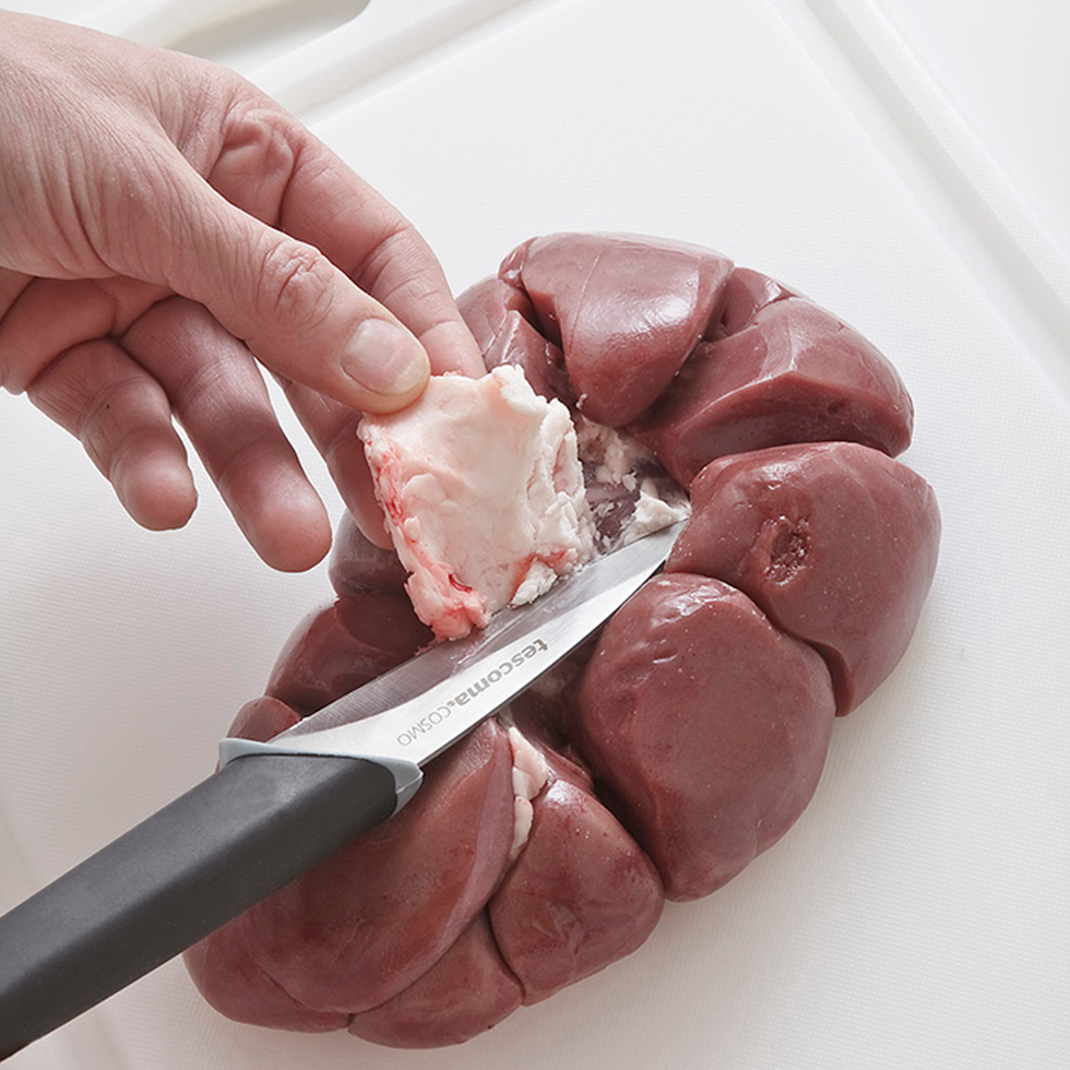Kidney